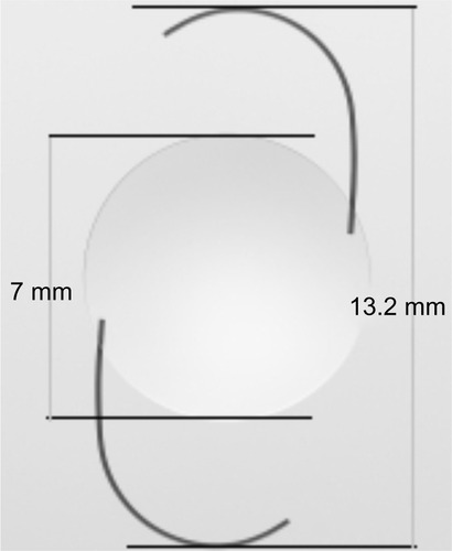 Figure 1 X-70 (Eternity®, Santen Co, Ltd, Osaka, Japan) is a three-piece, 4% water content, and hydrophobic acrylic intraocular lens. X-70 has a square-edge design with an optic diameter of 7.0 mm and an overall diameter of 13.2 mm.