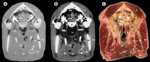 Figure 5. (A) Bone window CT image, (B) soft-tissue window CT image and (C) anatomic section at the level of pons.All views are rostral. 1, parietal bone; 2, transverse sinus; 3, temporal muscle; 4, cerebellar hemisphere; 5, cerebellar vermis; 6, fourth ventricle; 7, pons; 8, petrous part of temporal bone; 9, basilar part of occipital bone; 10, tympanic part of temporal bone; 11, pars nasalis pharyngis; 12, pars laryngea pharyngis; 13, medial pterygoideus muscle; 14, ramus of mandible; 15, parotid gland and masseter muscle; 16, pharyngeal muscles; 17, vestibule of larynx; 18, epiglottis; 19, hyoid bone; 20, mandibular gland.
