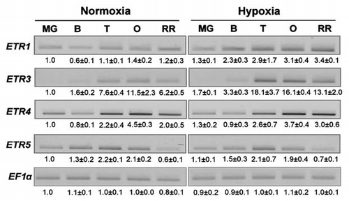 Figure 3 Semi-quantitative RT-PCR analysis of genes implicated in ethylene perception in fruits of control and hypoxically treated plants during the maturation phase. Signals were acquired using the Biorad Gel doc system and quantified with the quantity one software (Biorad). Values represent the mean ± SD (from two independent experiments) of the relative intensity of each signal normalized to MG control and EF1α signals. ETR: ethylene receptor.