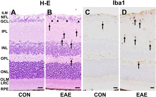 Figure 1. Histopathological examination of the retinas in the control and EAE-affected mice (EAE). (A and B) Hematoxylin-eosin staining revealed infiltration and/or activation of inflammatory cells (B, arrows) and loss of RGCs (B, arrowheads) in the EAE-affected retinas. (C and D) Immunohistochemistry for ionized calcium-binding adapter molecule (Iba1) was performed to detect retinal microglia. A few Iba1-positive resident microglia were observed in the control retinas (C, arrow). However, an increased number of Iba1-positive cells were detected in the EAE-affected retinas (D, arrows). The scale bars in the images represent 20 μm. The retinal layers are labeled as follows: inner limiting membrane (ILM), nerve fiber layer (NFL), ganglion cell layer (GCL), inner plexiform layer (IPL), inner nuclear layer (INL), outer plexiform layer (OPL), outer nuclear layer (ONL), outer limiting membrane (OLM), layer of rods and cones (LRC), retinal pigment epithelium (RPE).