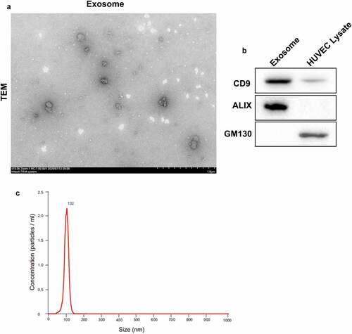Figure 2. Identification of exosomes. Exosomes were separated from HUVECs. (a) The ultrastructure of exosomes was observed under transmission electron microscopy. (b) The expression of CD9, ALIX and GM130 in exosomes or HUVEC lysate was assessed by WB. (c) The particle size of exosomes was analyzed by NanoSight nanoparticle tracking analysis