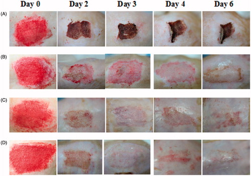 Figure 3. The representative images of wound model: (A) nontreated; (B) commercial product treated; (C) drug-free HD treated; (D) neomycin sulfate-loaded HD treated. The neomycin sulfate-loaded HDs were composed of drug, PVA, PVP and SA at the weight ratio of 1/10/0.8/0.8.