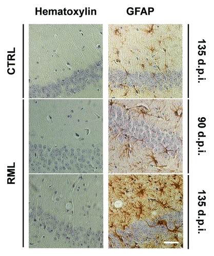 Figure 2. Progressive astrocytosis and spongiosis in the hippocampus of scrapie-infected mice. Coronal sections from saline-treated (CTRL) and RML-infected animals (i.c.) at 90 and 135 d.p.i were stained with hematoxylin alone or hematoxylin with the astrocytic marker Glial Fibrillary Acidic Protein (GFAP). Stainings highlight spongiosis and pronounced astrocytosis in the hippocampus of RML-infected mice at 135 d.p.i. Images are representative of 3 animals. Scale bar, 50μm.