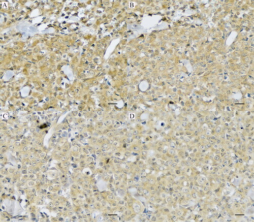 Figure 3. Canine PD-L1 immunohistochemical staining in cutaneous T-cell lymphoma. (A) Clone 5D2. (B) Clone 15D12. (C) Clone 18F2. (D) Clone 21A1. 400×. IHC. Bar = 10 µm.