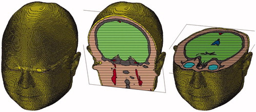 Figure 7. Whole and cross-section views of the head model.