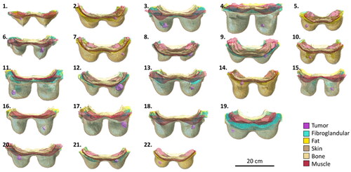 Figure 2. Top 3D view of all 22 generated breast cancer models. All models are on the same scale.