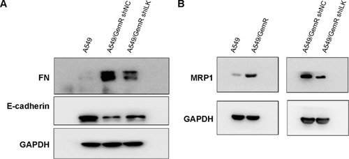 Figure 4 The molecular mechanism of ILK in gemcitabine-resistant lung cancer.