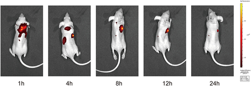 Figure 9 In vivo tumor targeting studies. Fluorescence imaging at 1, 4, 8, 12, and 24 hours after cRGD-Exos/miR-588 injection.