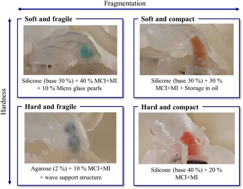 Figure 16. Selection and classification of thrombus models based on the properties of hardness and fragmentation in the defined categories.