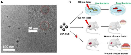 Figure 6 Schematic diagram of BSA-CuS antibacterial therapy. Reprinted with permission from Zhao Y, Cai Q, Qi W, et al. BSA-CuS nanoparticles for photother- mal therapy of diabetic wound infection in vivo. Biol Chem ChemBiol. 2018;3:9510–9516. Copyright 2018, John Wiley and Sons.Citation213 (A) HRTEM image of the BSA-CuS nanoparticles. (B) Schematic illustration of BSA-CuS nanoparticles as photothermal agent for photothermal antibacterial therapy in vitro and in vivo.