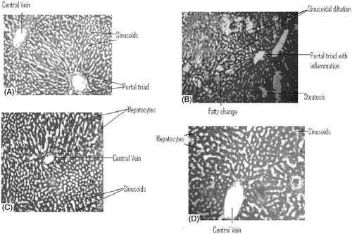 Figure 1. (A) Liver section of control rat. (B) Liver section of rat treated with Triton. (C) Liver section of rat treated with Standard drug. (D) Liver section of rat treated with S. indica ethanolic extract.