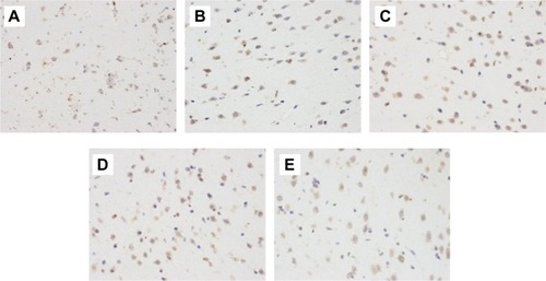 Figure 3 CD45+ expression in chronic hypoperfusion mice.