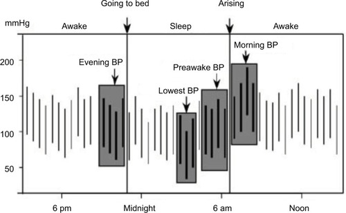 Figure 1 Measurements of morning blood pressure surge (MBPS).