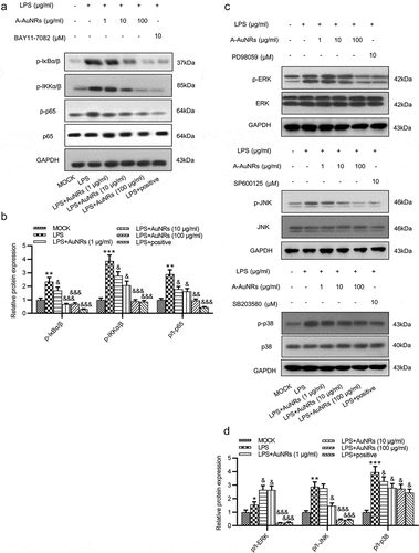 Figure 5. AuNPs inhibits the activation of the NF-κB and ERK/JNK signaling pathways. (a–d) Western blot was used to examine the levels of key proteins on the NF-κB and ERK/JNK signaling such as p-IκBα/β, p-IKKα/β, p-p65, p65, p-ERK, ERK, p-JNK, JNK, p-p38 and p38 after LPS treatment alone or in combination with AuNPs in NCM460 cells. BAY11-7082 was used as the inhibitor of NF-κB, while the PD98059 was used as inhibitor of ERK/JNK. *p < 0.05, **p < 0.01, ***p < 0.001, &p < 0.05, &&p < 0.01, &&&p < 0.001