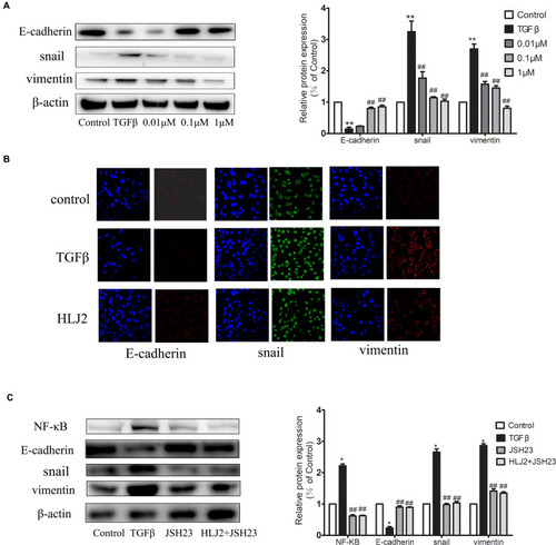 Figure 8 HLJ2 inhibited EMT-related markers in TGF-β1 induced SW480 cells by NF-κB p65 pathway. (A) The expression of E-cadherin, snail and vimentin in SW480 cells of all groups as determined by Western blot. HLJ2 (0.01μM, 0.1μM and 1μM) upregulated the expression of E-cadherin and downregulated the expression of snail and vimentin in SW480 cells in a dose-dependent manner after TGF-β induction. (B) Confocal immunofluorescence microscopy analysis of E-cadherin, snail and vimentin in TGF-β induced SW480 cells. Scale bar=60μm. Compared with TGF-β induced cells, HLJ2 (1μM) enhanced expression of E-cadherin and downregulated the expression levels of snail and vimentin in SW480 cells. (C) JSH23 reversed the process of EMT and the inhibition effect of HLJ2 on EMT was also not observed with addition of JSH23. *P < 0.05,**P < 0.01 compared with control group; ##P < 0.01 compared with AOM/DSS group. Mean values ± SEM are shown (n=3).