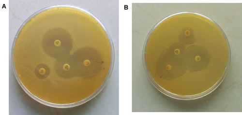 Figure 1 (A and B) The phenotypic confirmation test of ESBL producers performed using double disc synergy between amoxicillin-clavulanic acid and cefotaxime, ceftazidime, and aztreonam on Mueller-Hinton agar plate.
