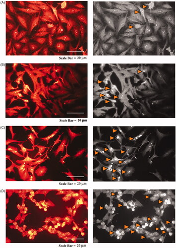 Figure 16. Fluorescence microscopy photographs of MCF-7 cells treated with modified nanohesperidin loaded in PLGA- Polixamar 407 and stained with SR 101.