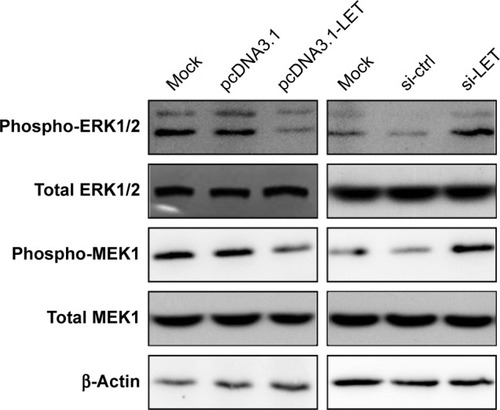 Figure 5 The phosphorylation status of ERK1/2 and MEK1 of CNE2 cells. CNE2 cells were transfected with pcDNA3.1-LET or si-LET, and the phosphorylation and total status of ERK1/2 and MEK1 were analyzed by Western blot.
