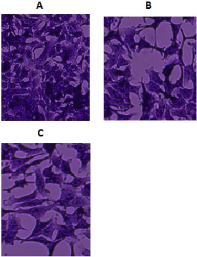 Figure 2. Morphological changes in MDA-MB-231 cells. The untreated cells were aggregated and clustered as monolayer forms (Figure 2A). Early morphological changes during apoptosis such as cell shrinkage and membrane blebbing in hyperforin treated MDA-MB-231 cells (Figure 2B). Cells treated with taxol exhibited early apoptosis signs like membrane blebbing and cell shrinkage (Figure 2C). Similar cellular morphology was observed in three independent experiments (magnification × 100).