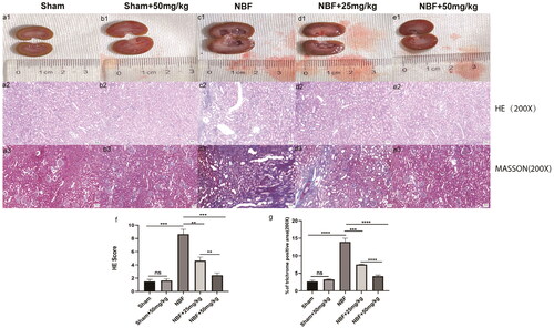 Figure 2. Staining of kidney tissue sections in each group.a1–e1 represent the general condition of the kidneys in the sham group, sham + ABT-263 group (50 mg/kg), NBF group, NBF + ABT-263 group (25 mg/kg), and NBF + ABT-263 group (50 mg/kg). a2–e2 represents the hematoxylin and eosin (HE) staining of the kidneys in each group. a3–e3 represent Masson staining of kidneys in each group. The kidneys in the sham and sham + ABT-263 group (50 mg/kg) groups were basically normal. The kidney damage and fibrosis in the NBF group were the most serious, followed by those in the NBF + ABT-263 group (25 mg/kg), and the kidney damage and fibrosis in the NBF + ABT-263 group (50 mg/kg) were greatly improved. f: Statistical histogram of renal HE staining scores in each group. g: Statistical histogram of renal Masson staining scores in each group. HE Scalebar = 50 μm. Masson Scale bar = 50 μm. Data are expressed as the mean ± SEM; ns p > 0.5, *p < 0.01, **p < 0.001, ***p < 0. 0001. All experiments were repeated three times.