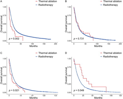 Figure 3. Kaplan–Meier survival curves for OS between the thermal ablation and radiotherapy groups when age was <65 years (A), 65–74 years (B), 75–84 years (C), or ≥85 years (D) before PSM. OS: overall survival; PSM: propensity score matching.