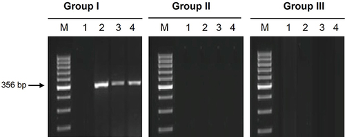 Figure 4 Molecular results of amplification of SAG 1 obtained from DNA isolated from blood samples by PCR in the different studied groups. M: molecular weight marker. G I: lane 1 was negative lanes 2, 3, 4 were positive. GII and III: All samples showing negative results.
