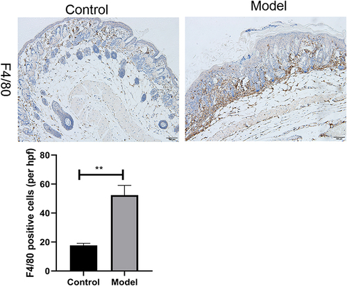 Figure 2 Immunohistochemistry of back skin lesion biopsies from control and psoriatic mice show the expression of F4/80. Quantification of IHC staining from control and psoriatic mouse skin lesions (n = 3) displayed as an average number of positive cells per high-powered field (hpf, × 200), respectively. Scale bar, 100 µm. Data are shown as the mean ± SEM, **P < 0.01.