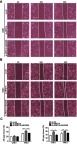 Figure S3 MK2006 partially rescued the enhanced migration ability induced by ARID1A silencing in NPC cells by wound scratch assays. *P<0.05, **P<0.01, #P<0.001.