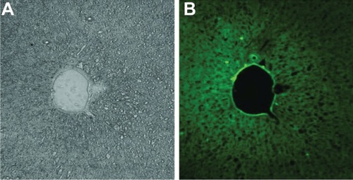 Figure 5 Fluorescein isothiocyanate-labeled nanoparticle localization in the liver after 4 hours of administration.Notes: (A) Transmitted image; (B) fluorescent image.