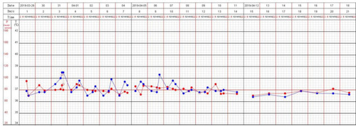 Figure 2 Record of the body temperature (blue) and heart rate (red) of the patient. From day 3 to day 10 after his admission, the patient had an intermittent fever from 18:00 to 22:00 every day, during which time, there was no obvious fluctuation in the heart rate.