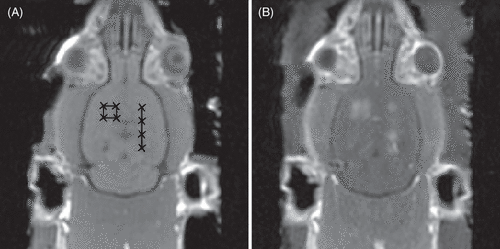 Figure 1. (A) baseline T1w MRI images of a rat brain showing target sonication locations. (B) contrast-enhanced T1w images post FUS BBBD showing enhancement indicating disruption at the eight target locations.