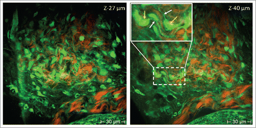 Figure 2. Nestin-GFP expressing hair follicle associated pluripotent (HAP) stem cells in the bulge imaged with multiphoton tomography at different depths (z-27 µm and z-40 µm). As shown in these 2-photon- (760 nm excitation) induced fluorescence images, nestin-GFP HAP stem cells within the whisker appear to have a specific morphology with a round-shaped body and typically 2–3 extrusions (GFP-green-colored cells). Extracellular matrix protein–collagen was imaged without external labeling based on a non-linear effect, termed the second-harmonic generation (red color [pseudo color coded]). 3D optical sectioning demonstrated that nestin-GFP HAP stem cells are distributed in the bulge area within a niche in perpendicular and horizontal sections (position) and well aligned within the collagen fibrillar structures. High intensity GFP fluorescence is detected either in the cell body, including the nucleus and extrusions, or only in the cytoplasm and extrusions but not in the nucleus. Yellow arrows indicate body and white arrows indicate extrusions of HAP stem cells.