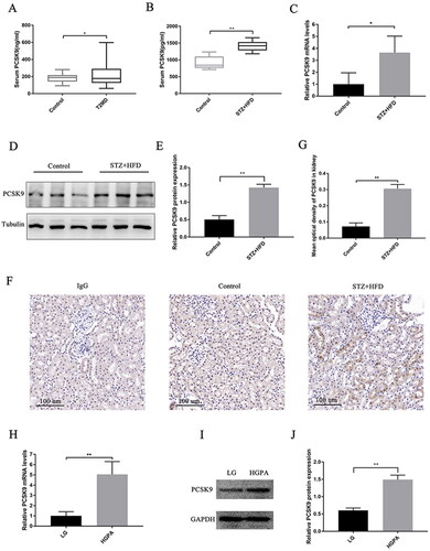 Figure 2. PCSK9 levels are elevated in DM. (A) Serum PCSK9 levels in T2DM patients and healthy control individuals. (B) Serum PCSK9 levels in STZ + HFD mice and control mice. (C) PCSK9 mRNA levels in kidney tissue of STZ + HFD mice and control mice. (D and E) Representative Western blot (left panel) and bar graph analysis (right panel) of PCSK9 levels in kidney tissue of STZ + HFD mice and control mice. (F and G) Representative immunohistochemical staining (left panel) and bar graph analysis (right panel) of PCSK9 levels in kidney tissue of STZ + HFD mice and control mice. Scale bar: 100 μm. (H) PCSK9 mRNA levels in HK-2 cells with HGPA and the control cells. (I and J) Representative Western blot and bar graph analysis of PCSK9 levels in HK-2 cells with HGPA and the control cells. *p < 0.05, **p < 0.01.