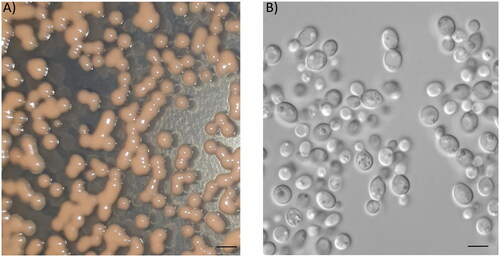 Figure 2. Morphology of Rhodotorula aurum sp. nov. (A) Colonies grown on YM plate for 2 days. Bar 1 mM. (B) Cells under microscopy (magnification of 100×). Bar 10 µM.