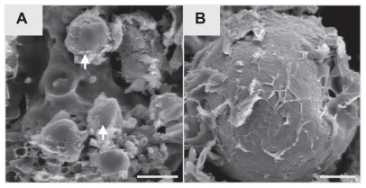 Figure 10 Representative SEM images (A, B) of SIBS 9 days after implantation. Arrows point to the implanted microparticles (A).Note: Scale bars: A = 20 μm, B = 9 μm.Abbreviations: SEM, scanning electron microscopy; SIBS, synthetic injectable bone substitute.