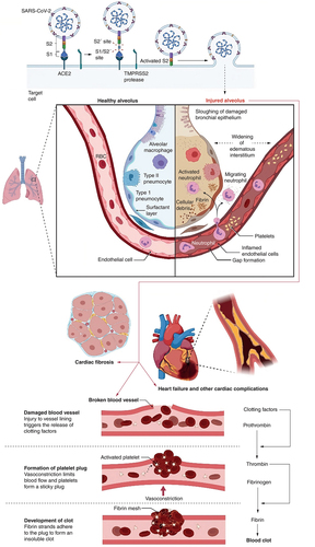 Figure 2. Mechanistic representation of cardiovascular complications that may occur during the post-COVID-19 recovery phase.Figure was originally created with biorender.com