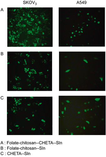 Figure 5.  The flourescence images of eGFP gene expression in SKOV3 cells (folate receptor over-expressing, R+) and A549 cells (folate receptor deficient, R-) transfected by three different kinds of nanoparticles at the absence of serum. It was observed under the inverse fluorescence microscope (Olympas, japan).