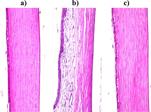 Figure 7. Photomicrographs of the rabbits’ corneas after instillation of; a) Normal saline solution (negative control), b) Isopropyl alcohol (positive control) and c) Optimum formula.