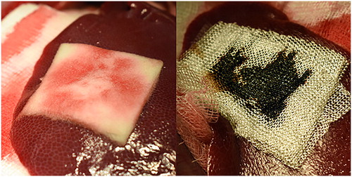 Figure 4. Test samples post application.ORC, oxidized regenerated cellulose; rT, recombinant thrombin plus gelatin sponge on the left, ORC on the right, after 3 layers have been applied.