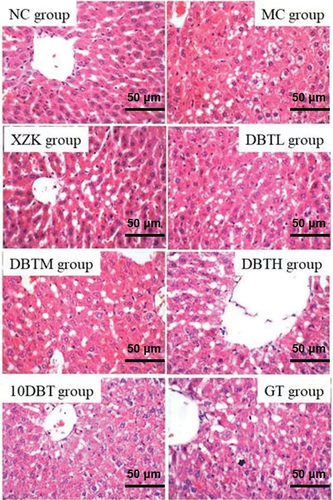 Figure 4. Liver cells pathological observations of each group rats.