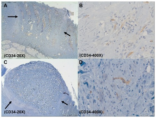 Figure 1 Representative CD34 histological figures of cutaneous wounds 1 week after wounding. At 20× wound margins are demonstrated (arrows) (A and C). At 400×, note increased endothelial cell counts in the placebo (about 11) (B) versus ranibizumab (about 6) (D).