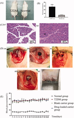 Figure 3. Animal model establishment, intraoperative and postoperative observation. The (A) general appearance and the (B) blood glucose levels of the T2DM and normal rats. (C) HE staining for pancreatic tissue of the (a) normal rats and the (b) T2DM rats. Scale bar = 50 μm. (D) Surgical procedure. (E) Daily blood glucose monitoring within 20 days after operation. ***p<.001.