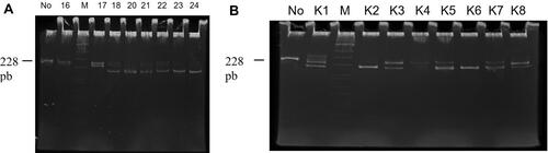 Figure 1 (A) Electrophoresis result from PCR-RFLP of HLA-DQA1 with Rsa1 restriction enzyme in T1DM groups. (B) Electrophoresis result from PCR-RFLP of HLA-DQA1 with Rsa1 restriction enzyme in control groups.