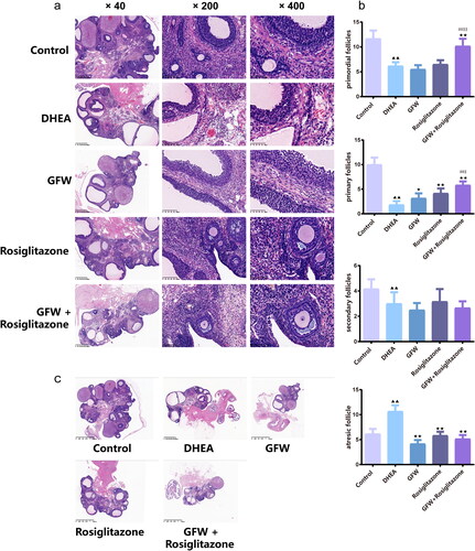 Figure 6. GFW and rosiglitazone co-intervention ameliorated ovarian histological change and follicular development in PCOS rats. (a) Hematoxylin and eosin (H&E) staining assessed the pathological change of the ovarian tissues (×40, ×200, ×400). (b) The number of follicles at all levels of the ovarian tissues was counted. (c) H&E staining of overall structure of ovary. Data are described as mean ± SD, n = 6. ▲▲p < .01 vs. control group; ★p < .05, ★★p < .01 vs. DHEA group; ##p < .01 vs. GFW group; $p < .05, $$p < .01 vs. rosiglitazone group.