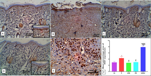 Figure 9. Representative photomicrograph of Ki-67 immunoexpression in skin section of different experimental groups. A: the control group shows no Ki-67 immunostained positive cells. C: the Diabetic + ZW and D: the diabetic + dapagliflozin groups show the same expression level of Ki-67 with high nuclear staining of epidermal cells. B: the diabetic group shows a moderate expression of Ki-67 in epidermal and dermal cells, inset, positive nuclear staining of epidermal, endothelial, and fibroblast cells. E: the diabetic + ZW + dapagliflozin group shows a strong nuclear expression of Ki-67 in epidermal and dermal cells. F: Histogram presented the percentage of skin immunostained with Ki 67. * vs. Control group; # vs. Diabetic group; @ vs. Diabetic + ZW group, and $ vs. Diabetic + dapagliflozin group. Image magnification = 400X, bar = 50 µm (A, B, C, and D), bar= 100 µm (E).