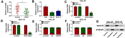 Figure 1 CircGDI2 expression was decreased in OSCC tissues and cells. (A and B) CircGDI2 expression by qRT-PCR in 30 pairs of OSCC tissues and matched normal tissues, HOK, CAL-27 and SCC-15 cells. Blots were representative of n = 3. (C and D) The levels of circGDI2 and GDI2 linear mRNA by qRT-PCR in RNase R-treated RNA extracts from CAL-27 and SCC-15 cells. Blots were representative of n = 6. (E and F) The subcellular localization of circGDI2 in both CAL-27 and SCC-15 cells. Error bars indicated SD of triplicate experiments. (G) The levels of lamin B and α-tubulin by Western blot in cytoplasmic and nuclear fractionations of CAL-27 and SCC-15 cells. A representative experiment was shown in triplicate. *P < 0.05.