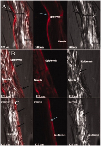 Figure 10. CLSM images revealing the penetration and distribution of Rhodamine 123 within albino rat skin when treated with nanoemulsion (NE), AmB-NE gel and Rhodamine 123 dye solution after being applied for 24 h: (A) NE; (B) AmB-NE gel; and (C) rhodamine 123 solution.