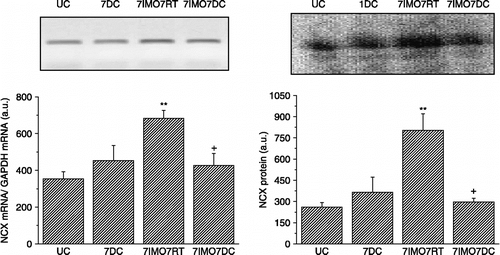 Figure 3  Effect of cold and immobilization alone or consecutively on NCX1mRNA (left) and protein (right) levels. UC—untreated control, 7DC—exposure to 4°C for seven consecutive days, 7IMO7RT—daily exposure to immobilization for 7 days, 2 h per day with subsequent rest for 7 days at room temperature, 7IMO7DC—daily exposure to immobilization for 7 days, 2 h per day with subsequent exposure to cold for seven consecutive days. Values are displayed as mean ± SEM; n, 6–8 rats per group. One-way ANOVA: p = 8.425 × 10− 4, F = 11.244 (left), p = 4.662 10− 14, F = 793.3528 (right) **p < 0.01 vs. UC; +p < 0.05 vs. 7IMO7RT.