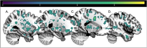 Figure 3. Whole Brain RSA searchlight contrast results for Schematic information similarity > Lure information similarity, thresholded at p < .001 and 11 voxels. No clusters survived thresholding for Lure information similarity > Schematic information similarity. Sagittal slices: −30, −24, 17, 44. Dotted circles around: [A] Anterior HC, [B] Posterior HC, [C] MFG, [D] MTG. Colour bar indicates t-values.