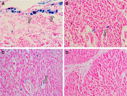 Figure 6 Prussian blue staining of tumor tissues after intravenous injection of RGD-PAA-USPIO (A), plain USPIO (B), or RGD-PAA-USPIO plus free RGD peptides (C) and conventional HE staining (D) (×200).Note: The arrow in the figures refer to the different iron particles of Prussian blue staining from RGD-PAA-USPIO(A), plain USPIO (B), and RGD-PAA-USPIO plus free RGD (C).Abbreviations: HE, hematoxylin and eosin; PAA, polyacrylic acid; RGD, arginine-glycine-aspartic acid; USPIO, ultrasmall superparamagnetic iron oxide.